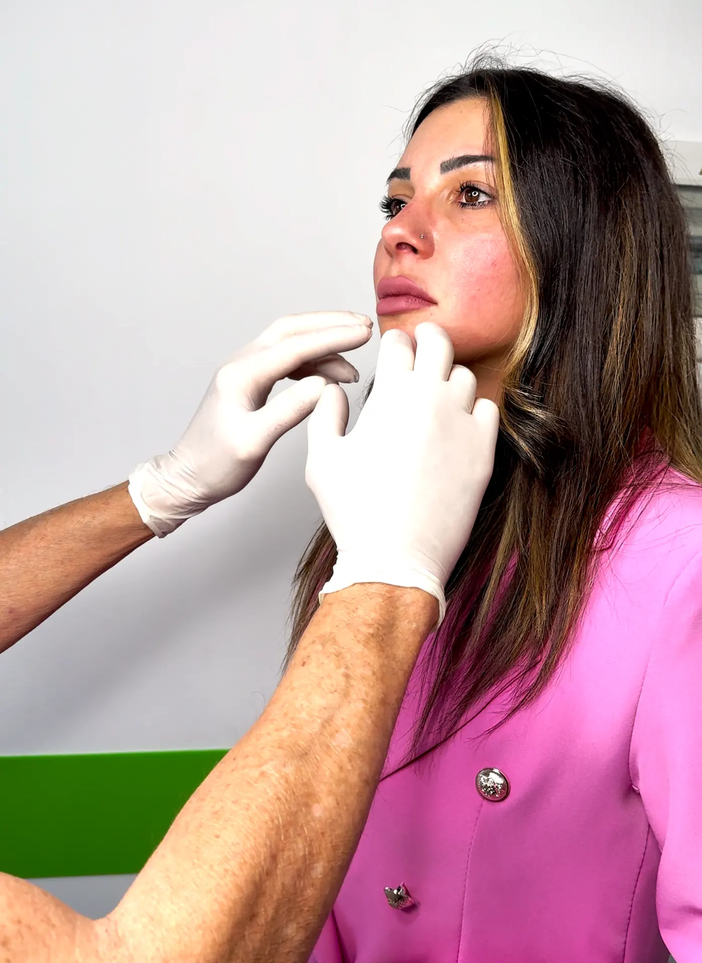 Filler labbra a Rivoli