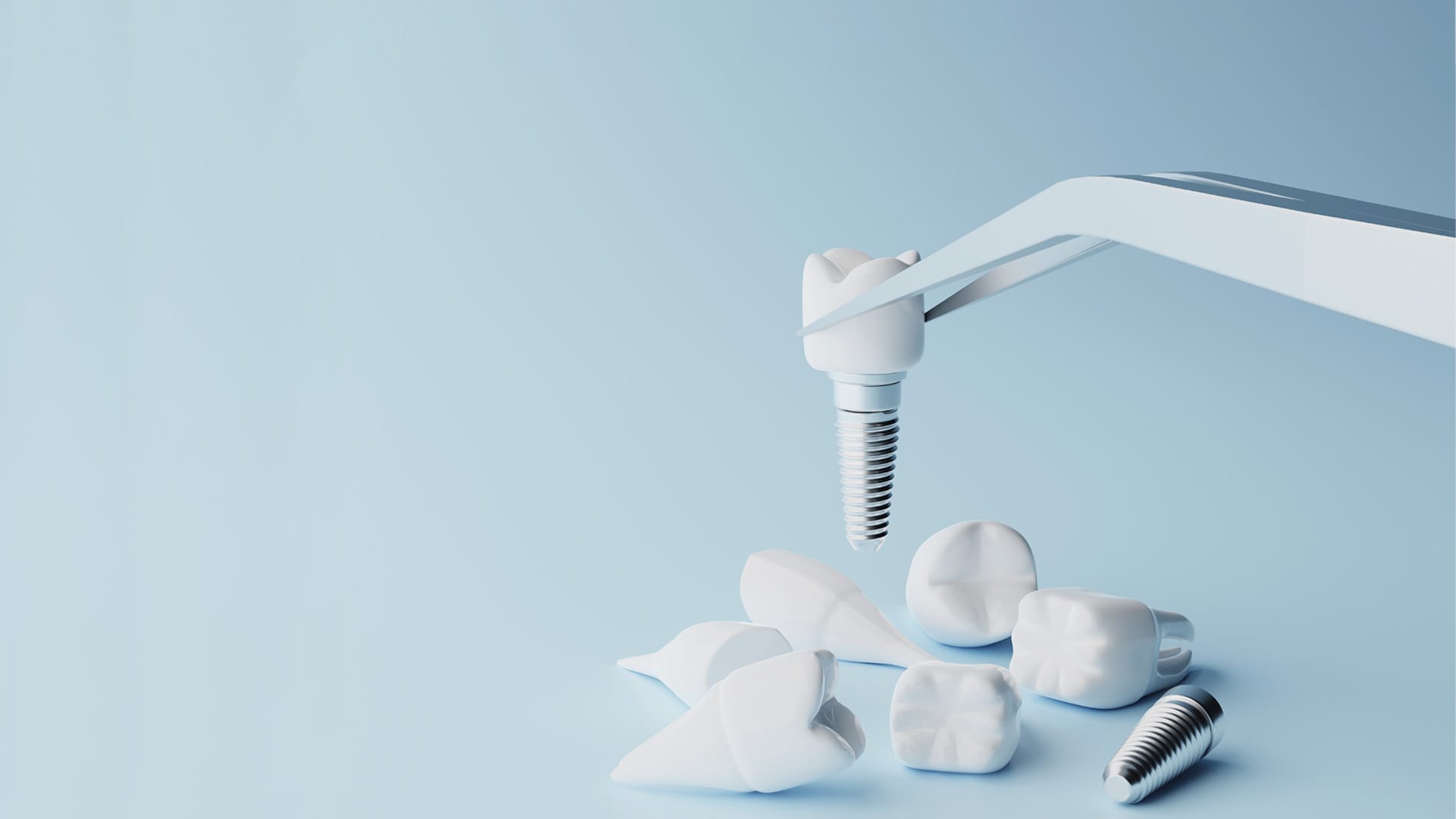 quanto dura un impianto dentale