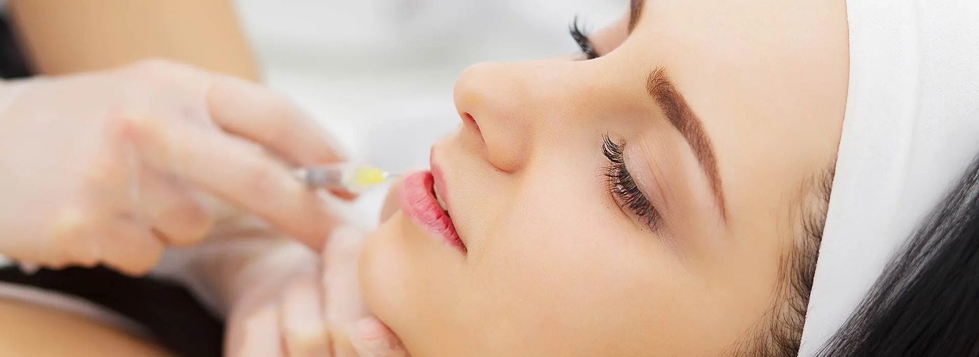 quanto dura il filler alle labbra, filler labbra a rivoli