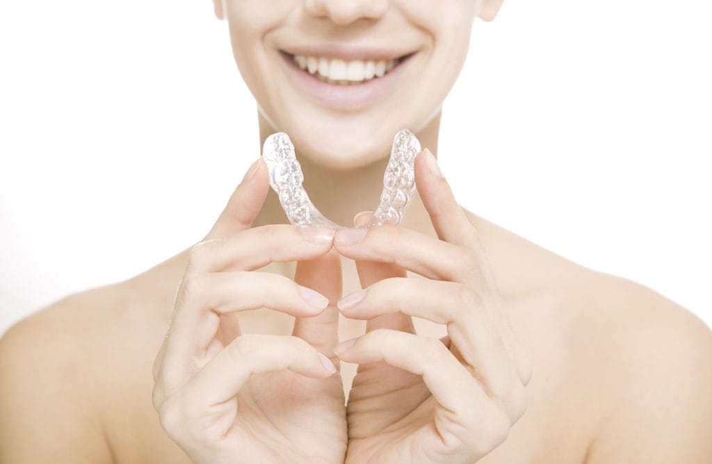 allineatori trasparenti