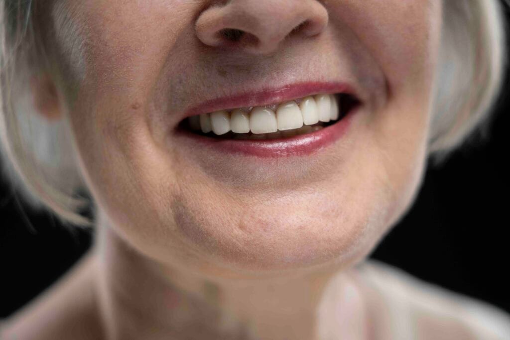 Differenza tra dentiera e protesi fissa