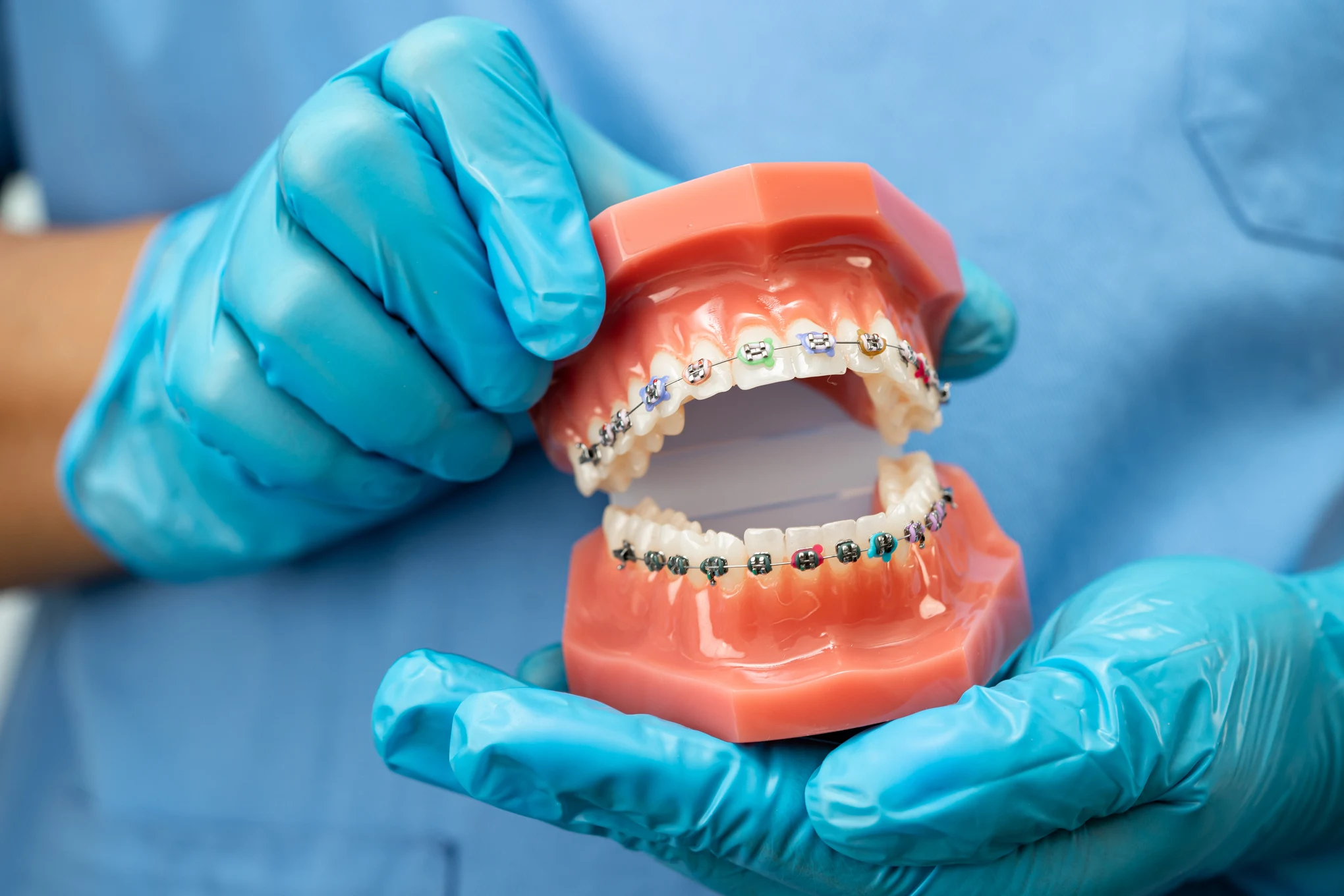 Dentista a Rivoli - apparecchio dentale a Rivoli