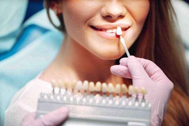 fa male mettere le faccette dentali