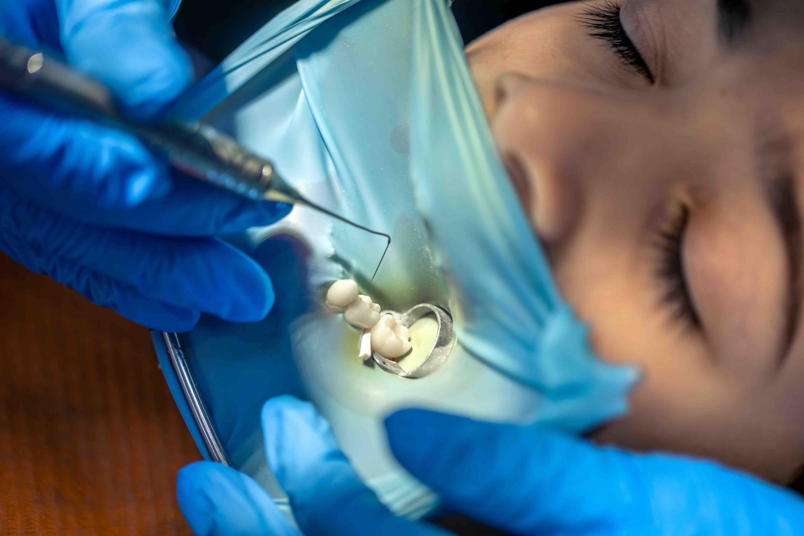ricostruzioni estetiche